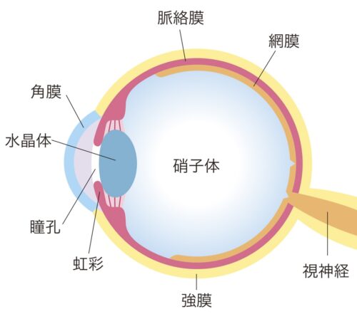 icl 屈折矯正のしくみ