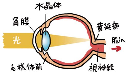 icl 眼精疲労